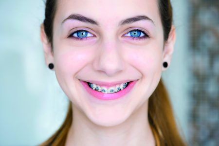 Higienizacja pacjenta ortodontycznego