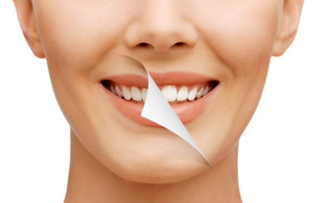 Wybielanie zębów metodą BEYOND w szczegółach